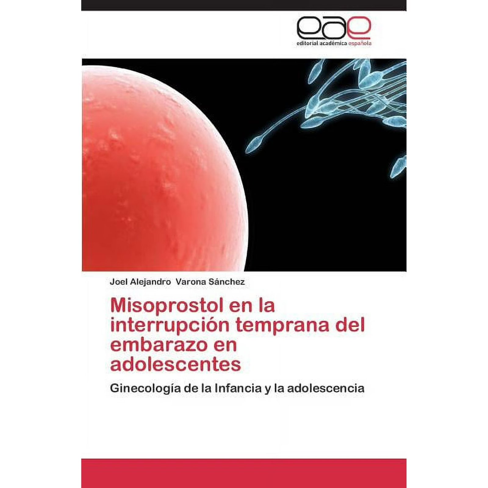 Misoprostol En La Interrupcion Temprana del Embarazo En Adolescentes (Paperback 9783848454099) by Varona Sanchez Joel Alejandro  978-3848454099